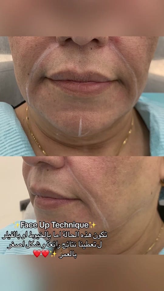 Post 10 by Dr. Ali Hamzah Assaf on TikTok (video)