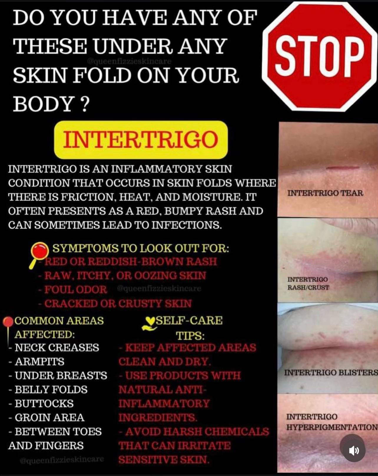 Post 2 by Niniluxuryglowskincare&Medspa on TikTok (video)