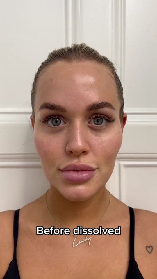 Post 10 by HARLEY STREET INJECTABLES on TikTok (video)