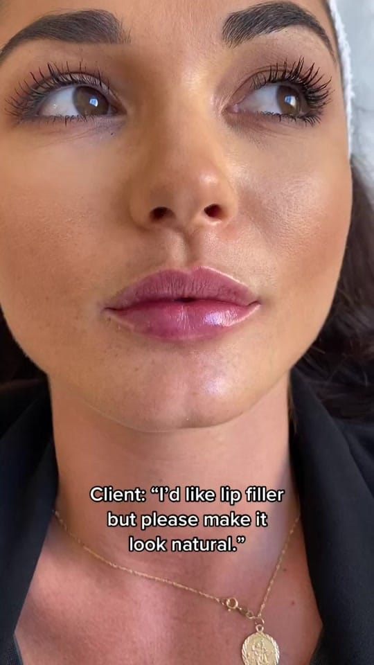 Post 9 by HARLEY STREET INJECTABLES on TikTok (video)