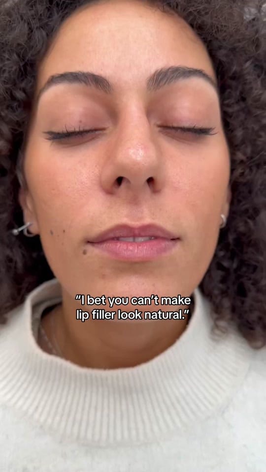 Post 8 by HARLEY STREET INJECTABLES on TikTok (video)