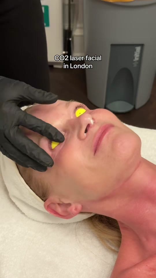 Post 1 by HARLEY STREET INJECTABLES on TikTok (video)