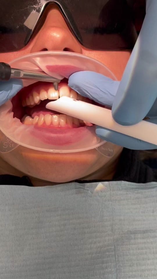Post 8 by 3Dental on TikTok (video)