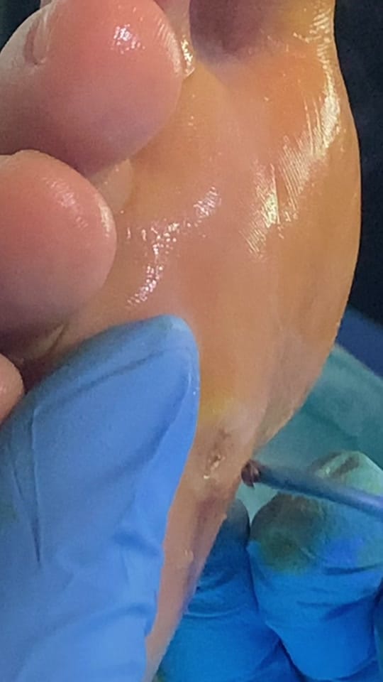 Post 8 by The Podiatry Clinic on TikTok (video)