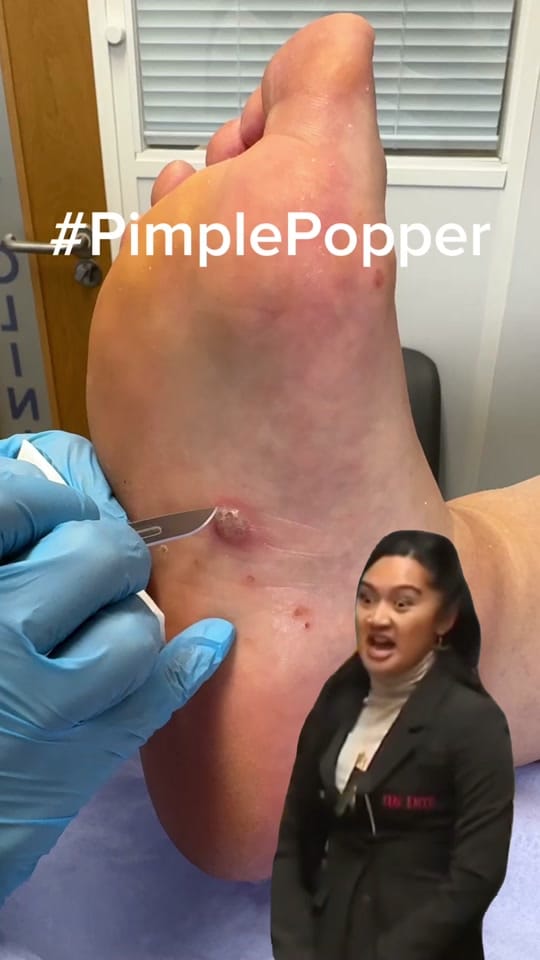 Post 9 by The Podiatry Clinic on TikTok (video)