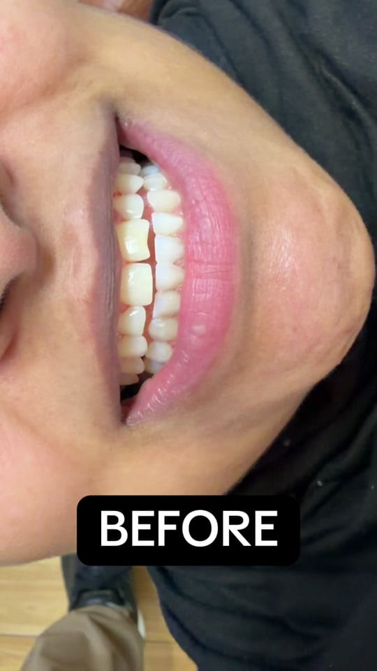 Post 6 by 1Kingsdental on TikTok (video)