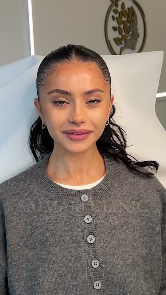 Post 10 by saimariclinic on TikTok (video)