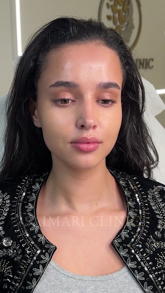 Post 9 by saimariclinic on TikTok (video)
