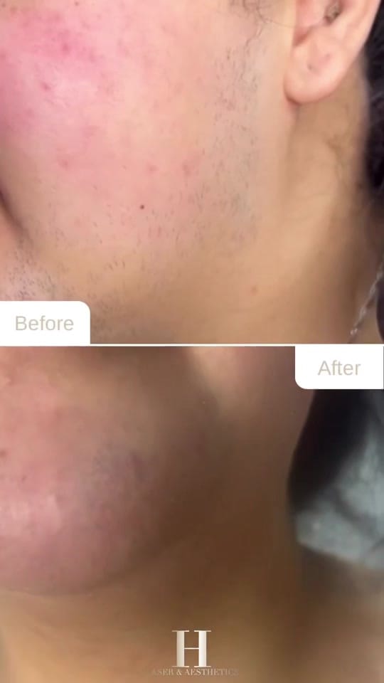 Post 10 by HeraLaserandSkin on TikTok (video)