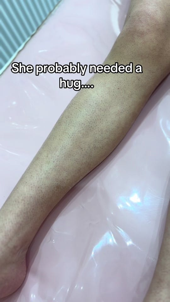 Post 9 by HeraLaserandSkin on TikTok (video)