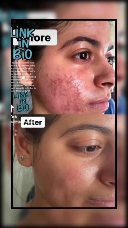 Post 7 by Hunny Bee Natural ! on TikTok (video)