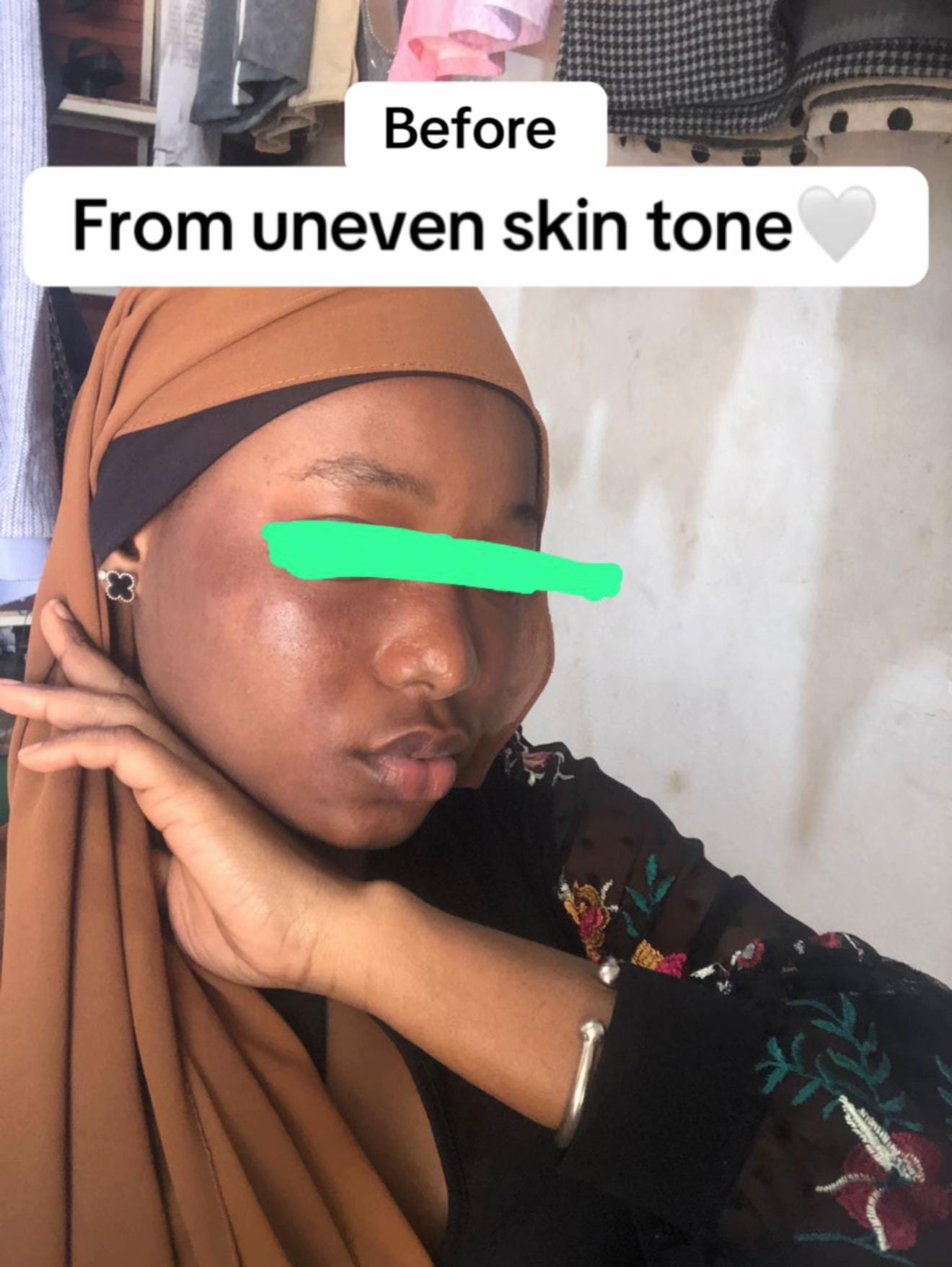 Post 6 by Beautyspot Skincare🇬🇲 on TikTok (video)