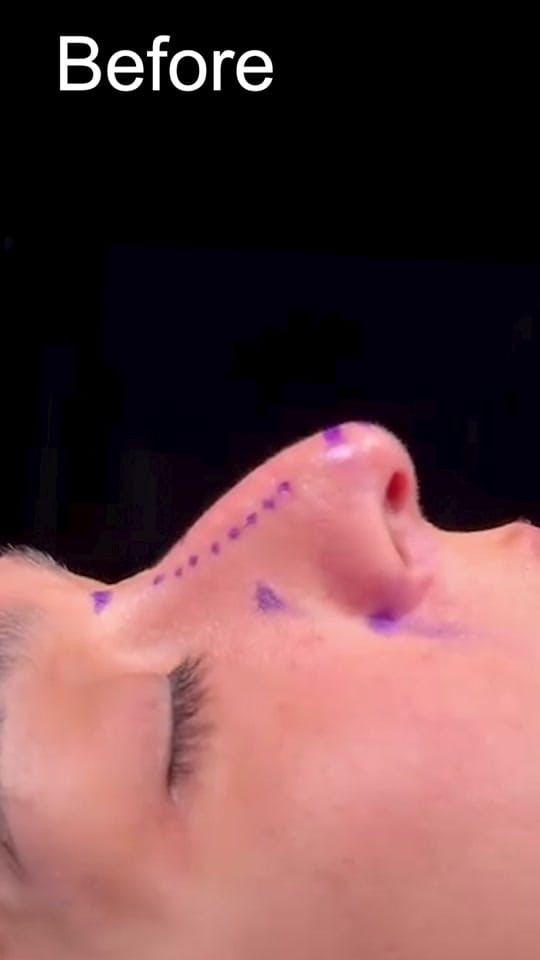 Post 3 by Aaron Kosins MD on TikTok (video)