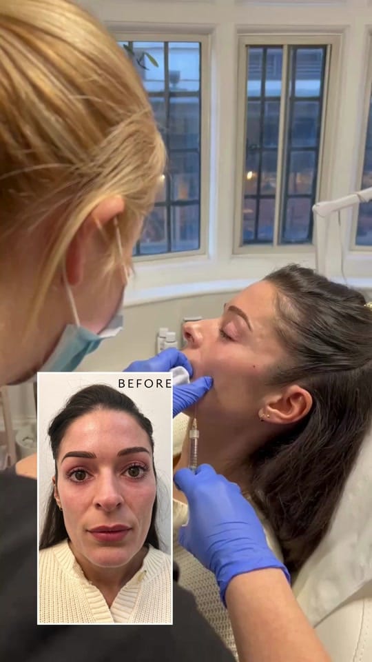 Post 7 by Dr Siddiqi MBBS BSc MRCGP on TikTok (video)