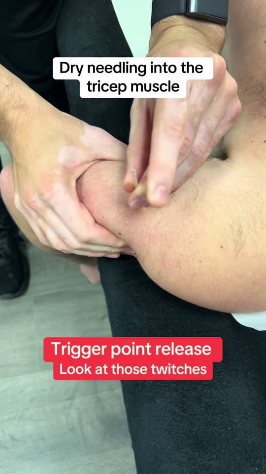 Post 10 by 5Physio on TikTok (video)