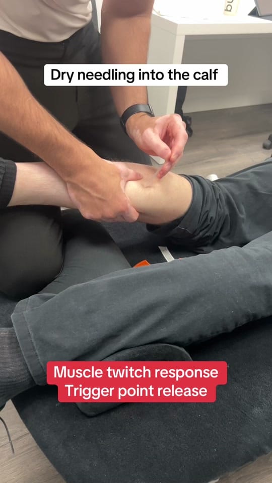 Post 2 by 5Physio on TikTok (video)