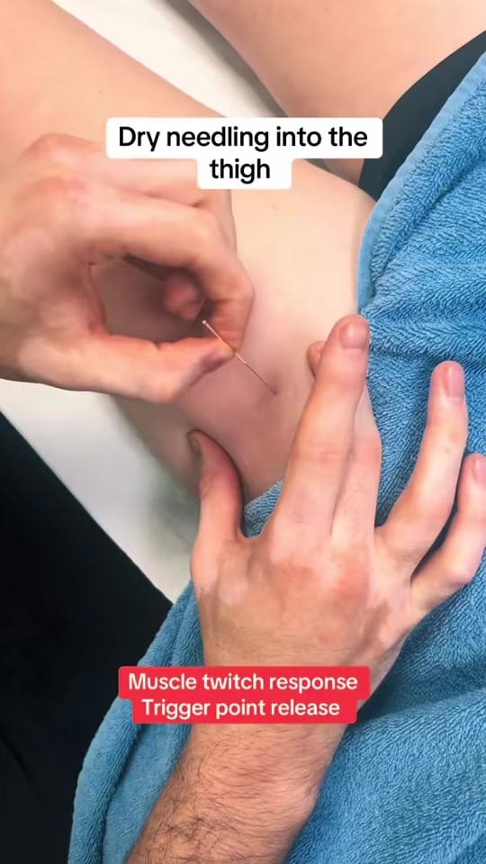 Post 5 by 5Physio on TikTok (video)
