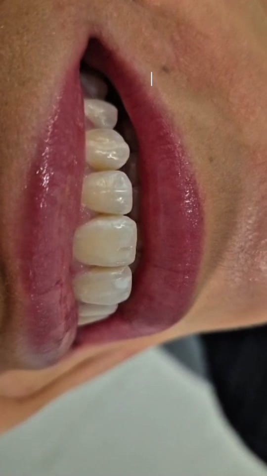 Post 1 by Vitruvian Dental Studio on TikTok (video)