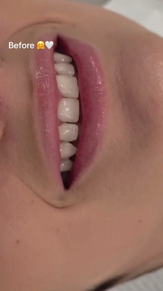 Post 6 by Vitruvian Dental Studio on TikTok (video)