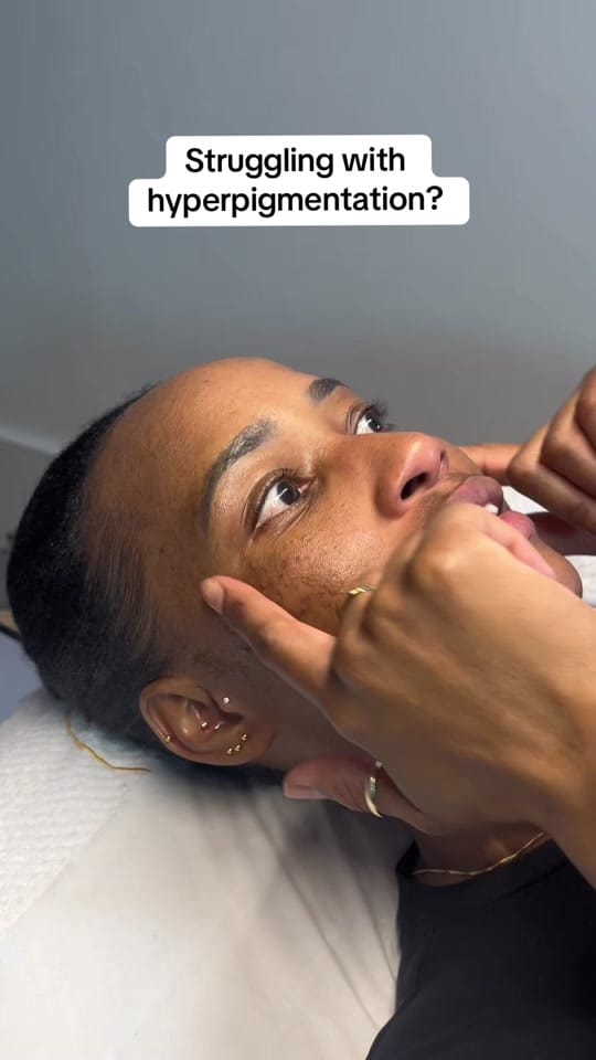 Post 10 by EC Aesthetic London on TikTok (video)