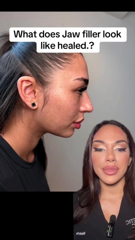 Post 8 by Aesthetic clinic london on TikTok (video)