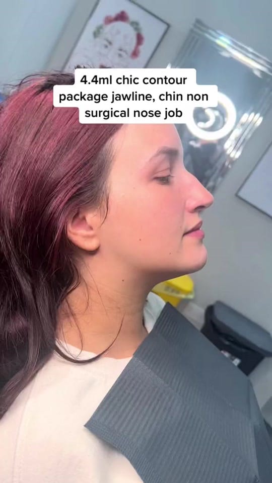 Post 7 by Aesthetic clinic london on TikTok (video)