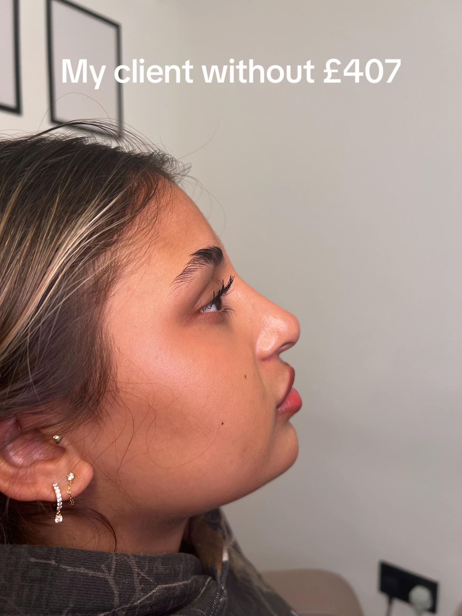Post 2 by Aesthetic clinic london on TikTok (video)