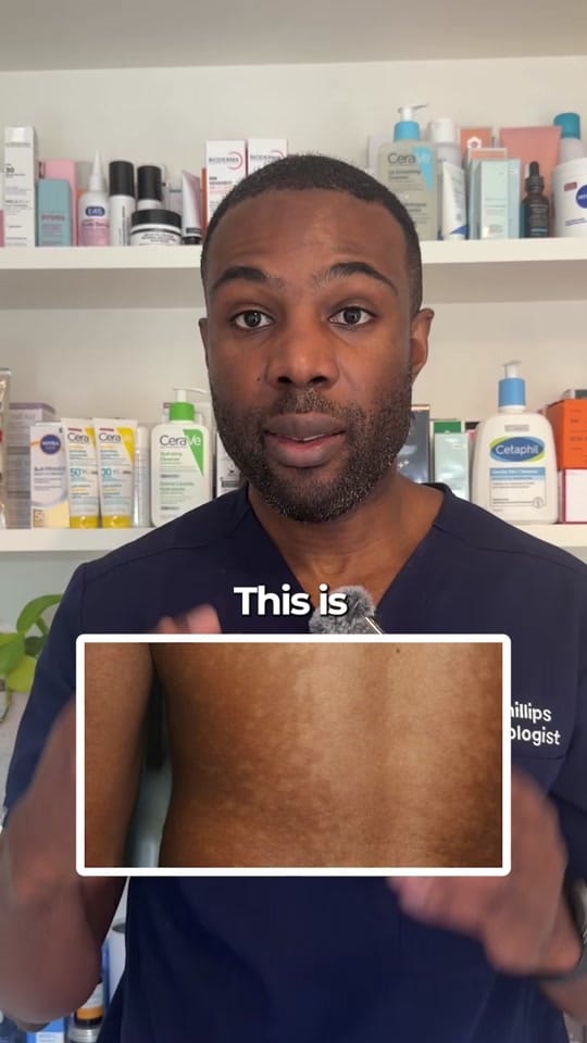 Post 9 by Dr Derrick Phillips on TikTok (video)