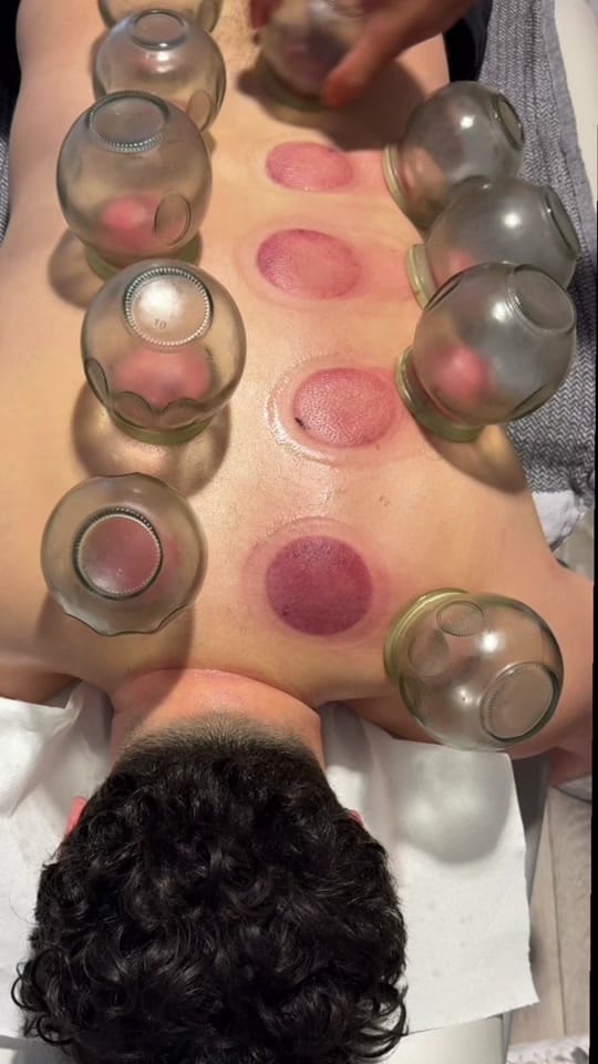Post 4 by icaht_clinic on TikTok (video)