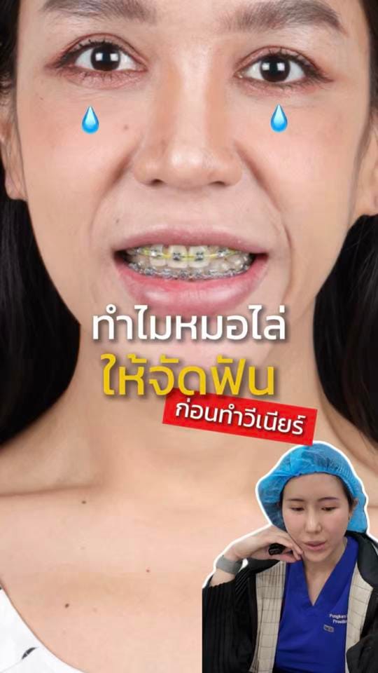 Post 7 by หมอป่องสวยมาก veneer 🦷 on TikTok (video)