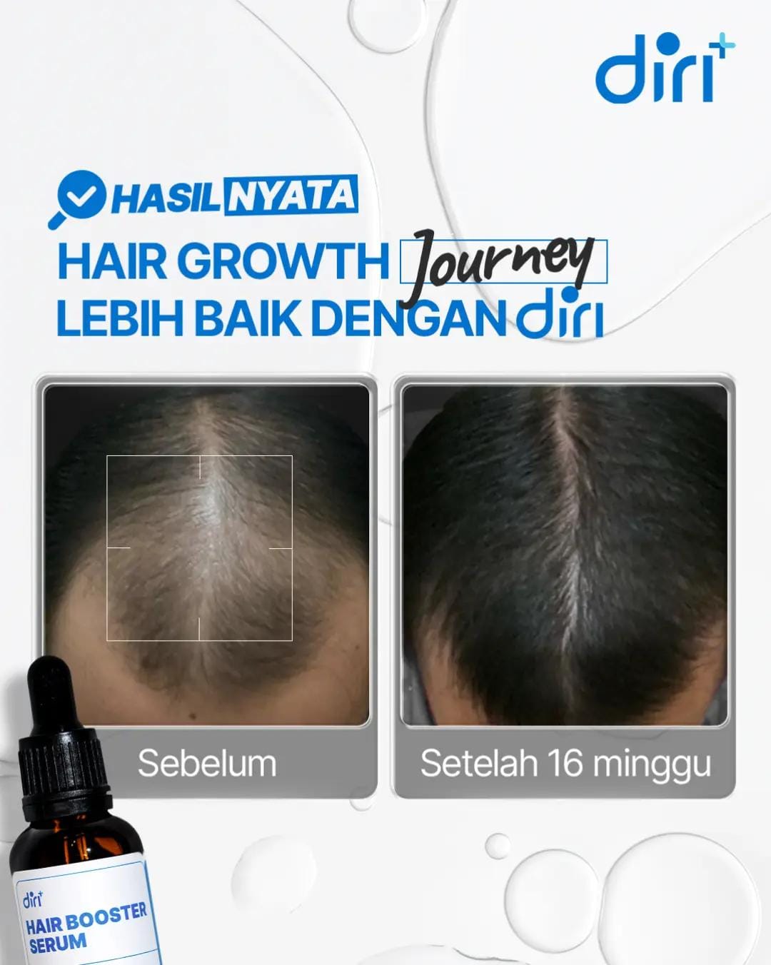 Post 8 by Diri Care on TikTok (video)