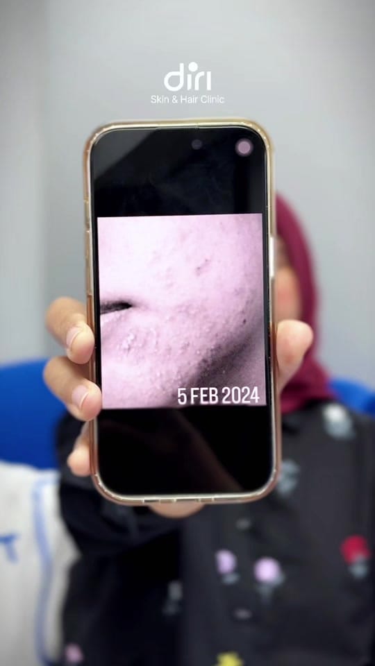Post 6 by Diri Care on TikTok (video)