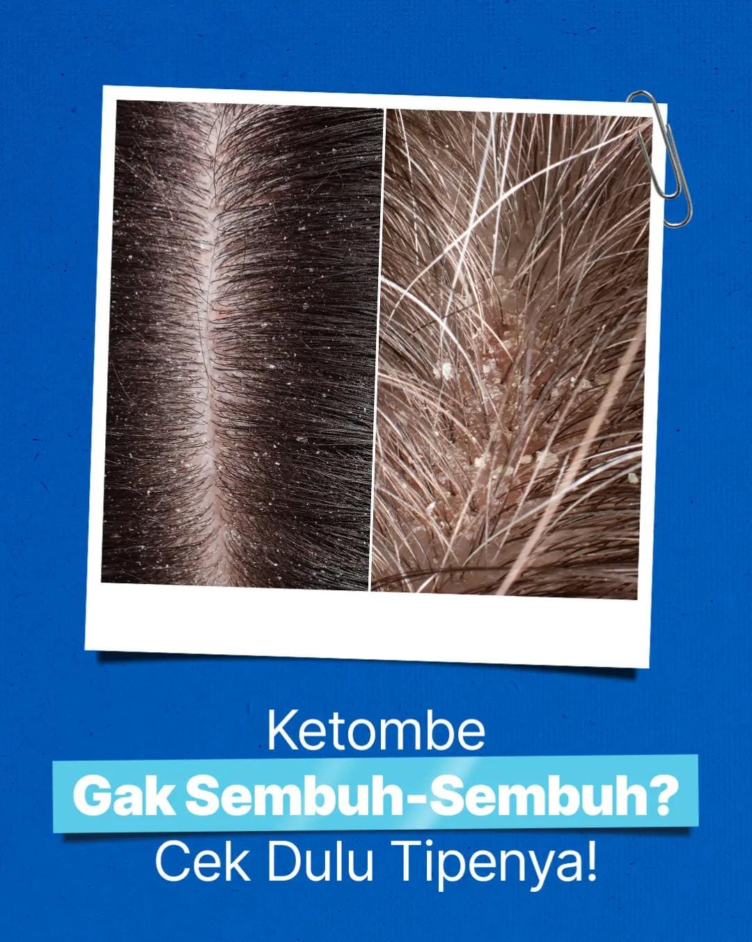 Post 7 by Diri Care on TikTok (video)