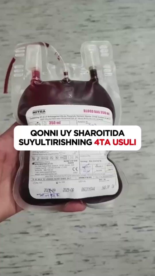 Post 5 by Dr. Shohjahon Alisherovich on TikTok (video)