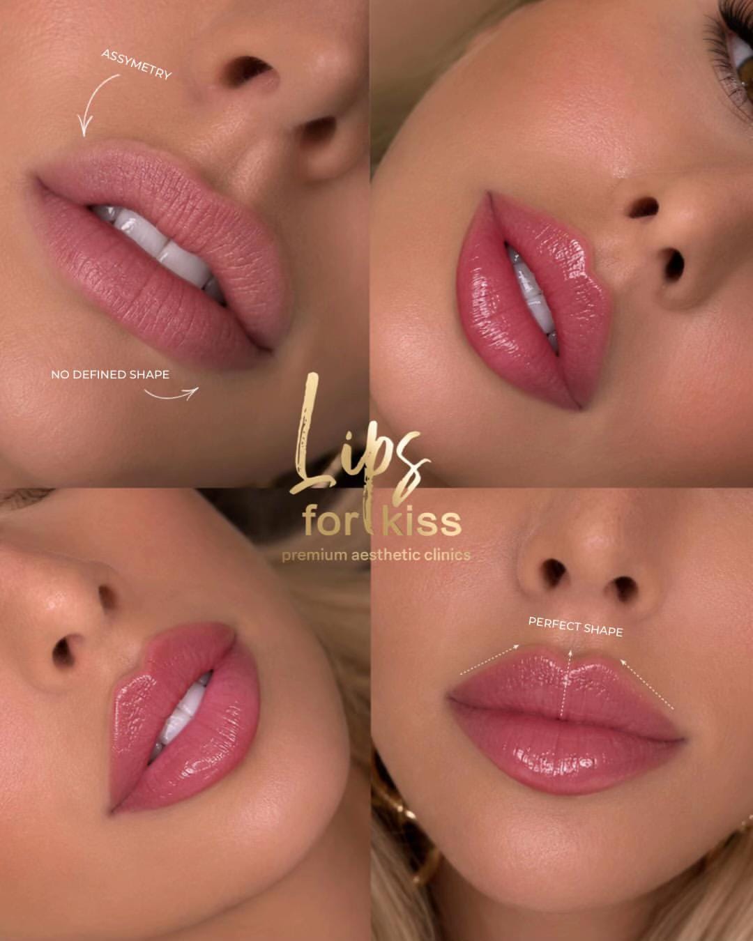 Post 2 by Lips_for_kiss on TikTok (video)