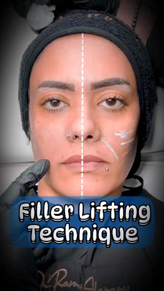 Post 1 by DrRamy Alanany on TikTok (video)
