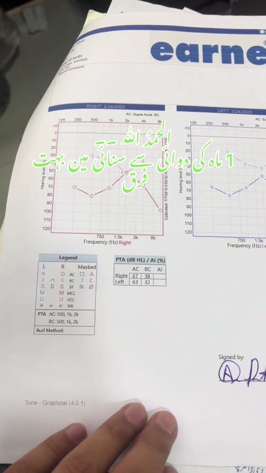 Post 6 by Dr Rahmat Qureshi ENT on TikTok (video)