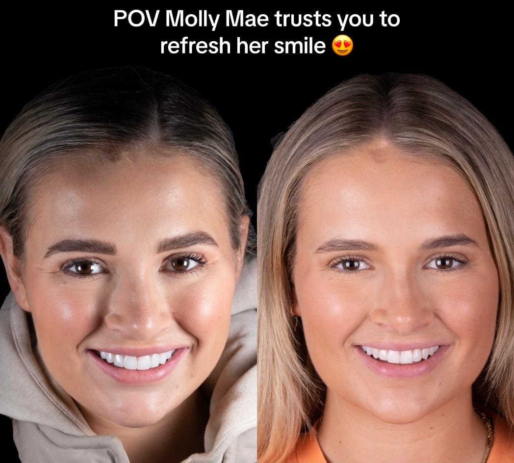 Post 10 by Ruh Dental on TikTok (video)