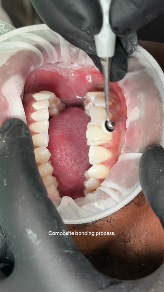 Post 2 by Ruh Dental on TikTok (video)