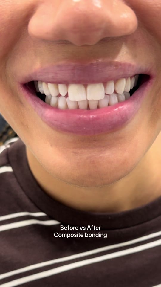 Post 5 by Ruh Dental on TikTok (video)
