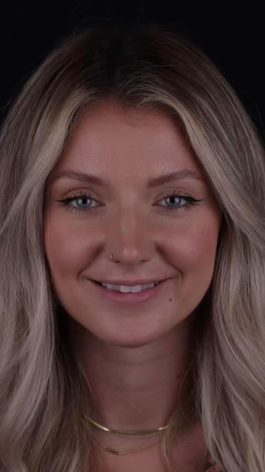 Post 3 by Ruh Dental on TikTok (video)