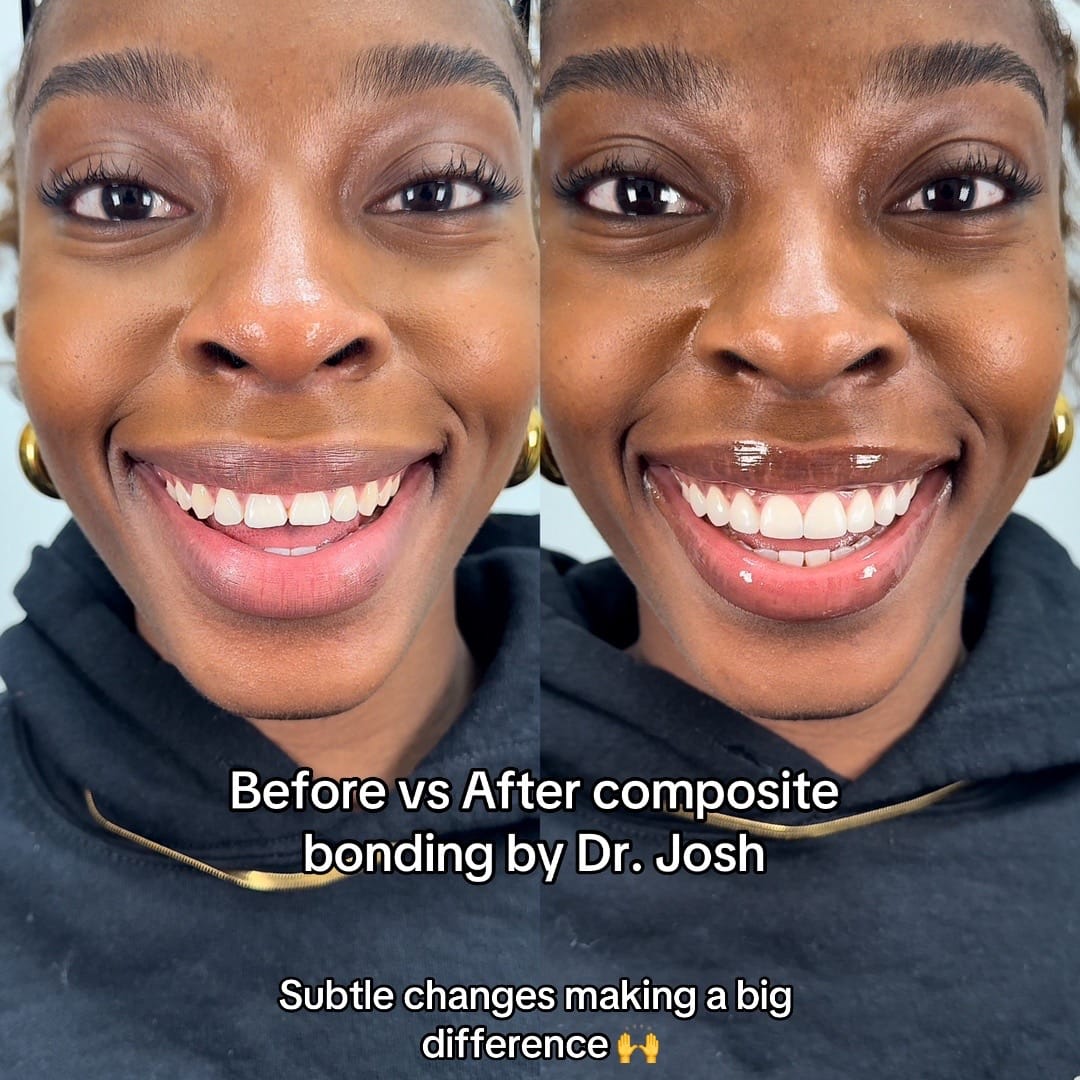 Post 8 by Ruh Dental on TikTok (video)