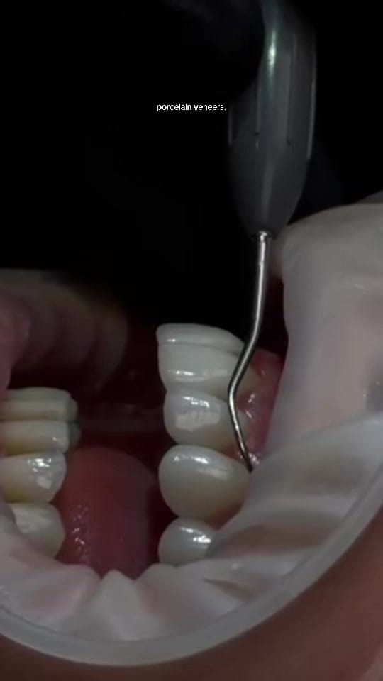 Post 6 by Ruh Dental on TikTok (video)