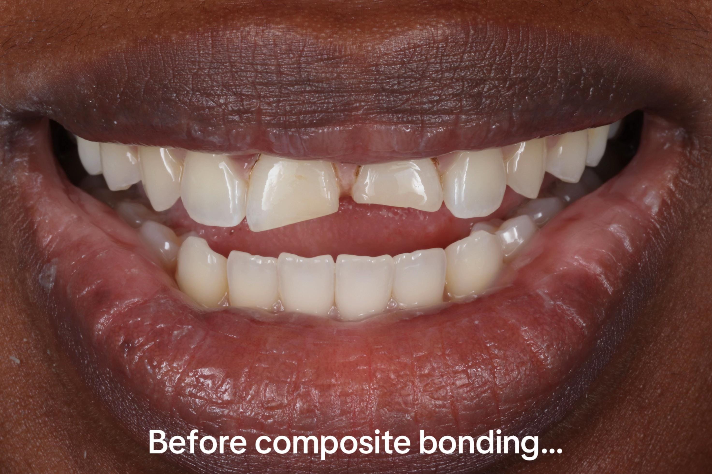 Post 4 by Ruh Dental on TikTok (video)