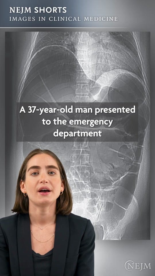 Post 10 by NEJM on TikTok (video)