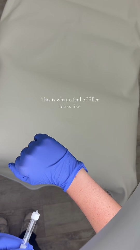 Post 3 by Grace aesthetics clinic on TikTok (video)