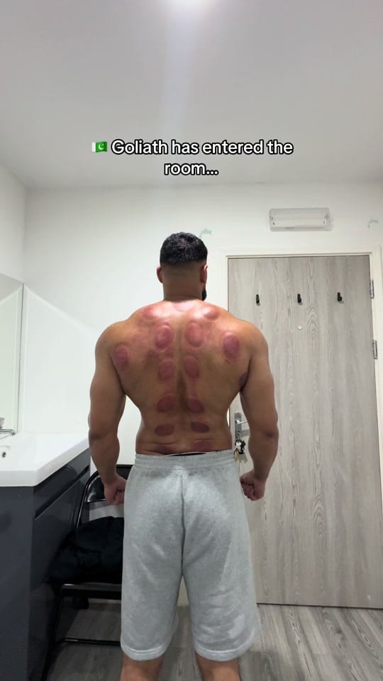Post 7 by Recharge Clinic on TikTok (video)