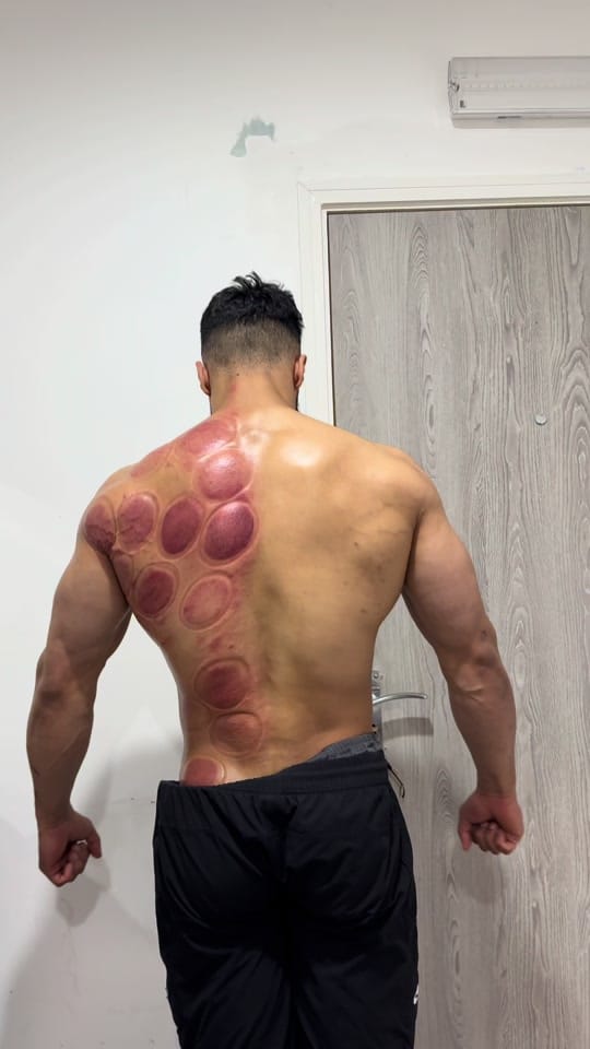 Post 8 by Recharge Clinic on TikTok (video)
