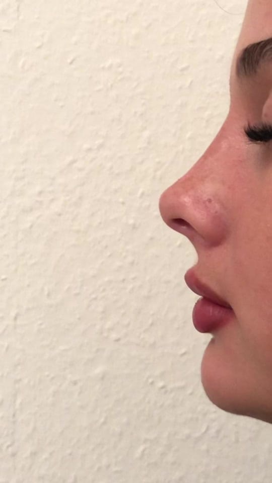 Post 2 by BERYBEAUTY on TikTok (video)