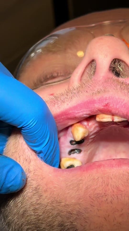Post 4 by Dr Dalghous on TikTok (video)